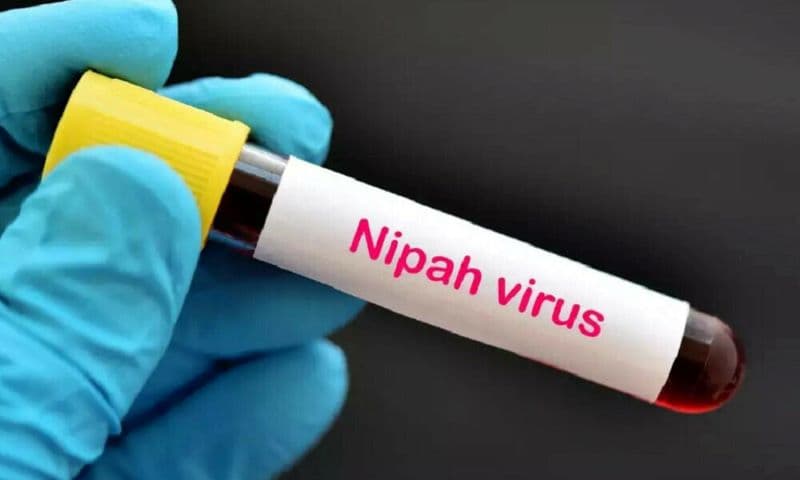 Virus Nipah là gì? Triệu chứng và cách phòng ngừa lây nhiễm